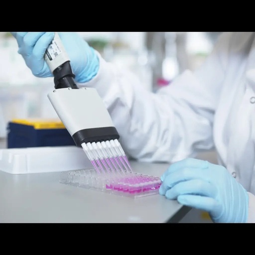 [E5975b] Bovine ATP6V1B1 / V type proton ATPase subunit B  kidney isoform ELISA Kit